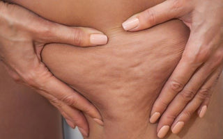 PARLONS CELLULITE LES FILLES !! conseil cellulite, astuces femme pour cellulite